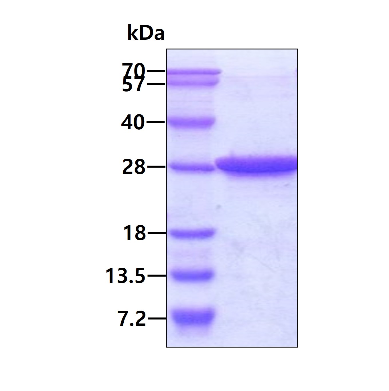 3 μg by SDS-PAGE under reducing condition and visualized by coomassie blue stain.